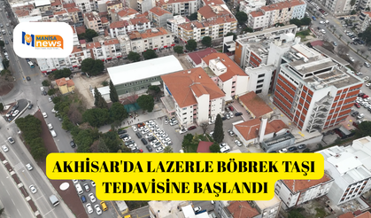 Akhisar'da lazerle böbrek taşı tedavisine başlandı