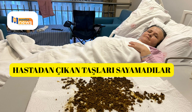 Hastadan çıkan taşları sayamadılar